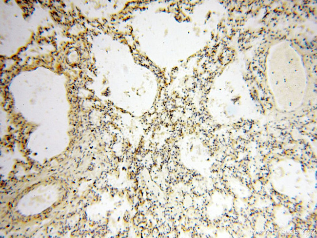 EHBP1 Antibody in Immunohistochemistry (Paraffin) (IHC (P))