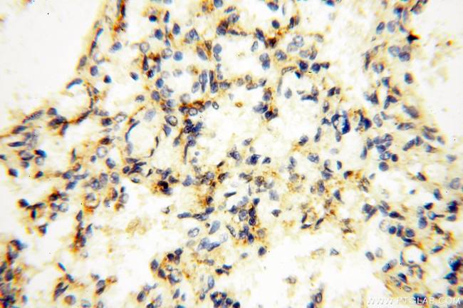 EHBP1 Antibody in Immunohistochemistry (Paraffin) (IHC (P))