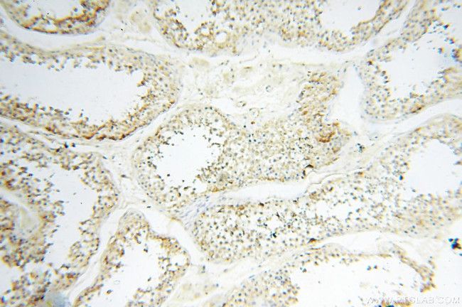 EHBP1 Antibody in Immunohistochemistry (Paraffin) (IHC (P))