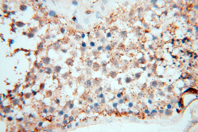 EHBP1 Antibody in Immunohistochemistry (Paraffin) (IHC (P))