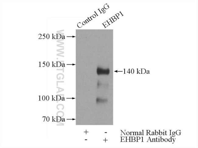 EHBP1 Antibody in Immunoprecipitation (IP)