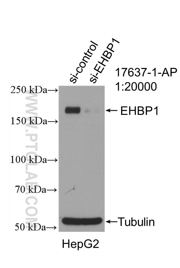 EHBP1 Antibody in Western Blot (WB)