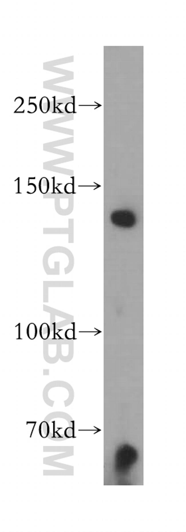 EHBP1 Antibody in Western Blot (WB)