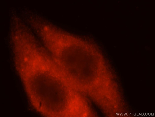 HMGCS1 Antibody in Immunocytochemistry (ICC/IF)