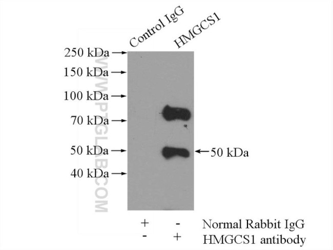 HMGCS1 Antibody in Immunoprecipitation (IP)