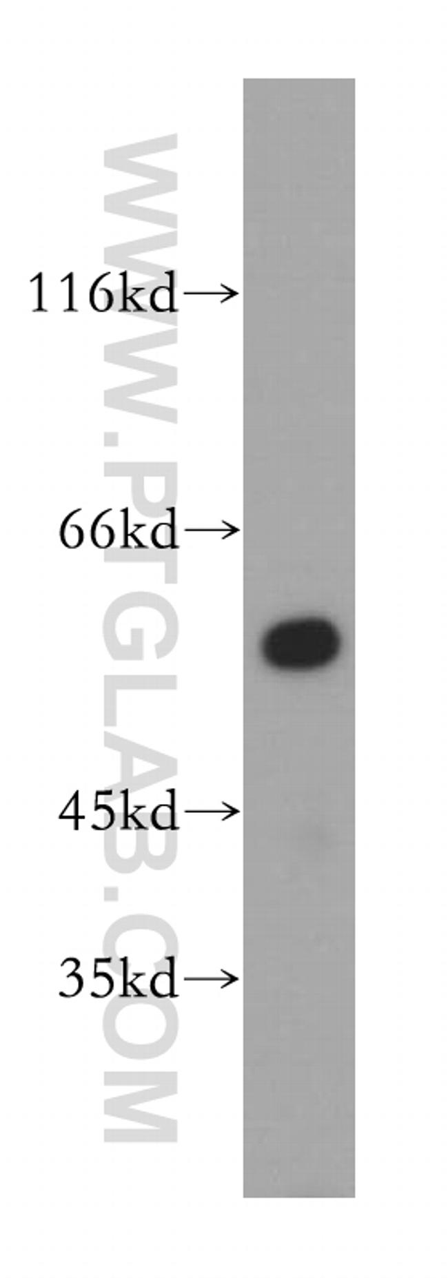 HMGCS1 Antibody in Western Blot (WB)