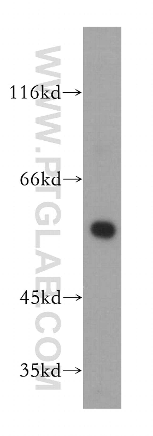 HMGCS1 Antibody in Western Blot (WB)