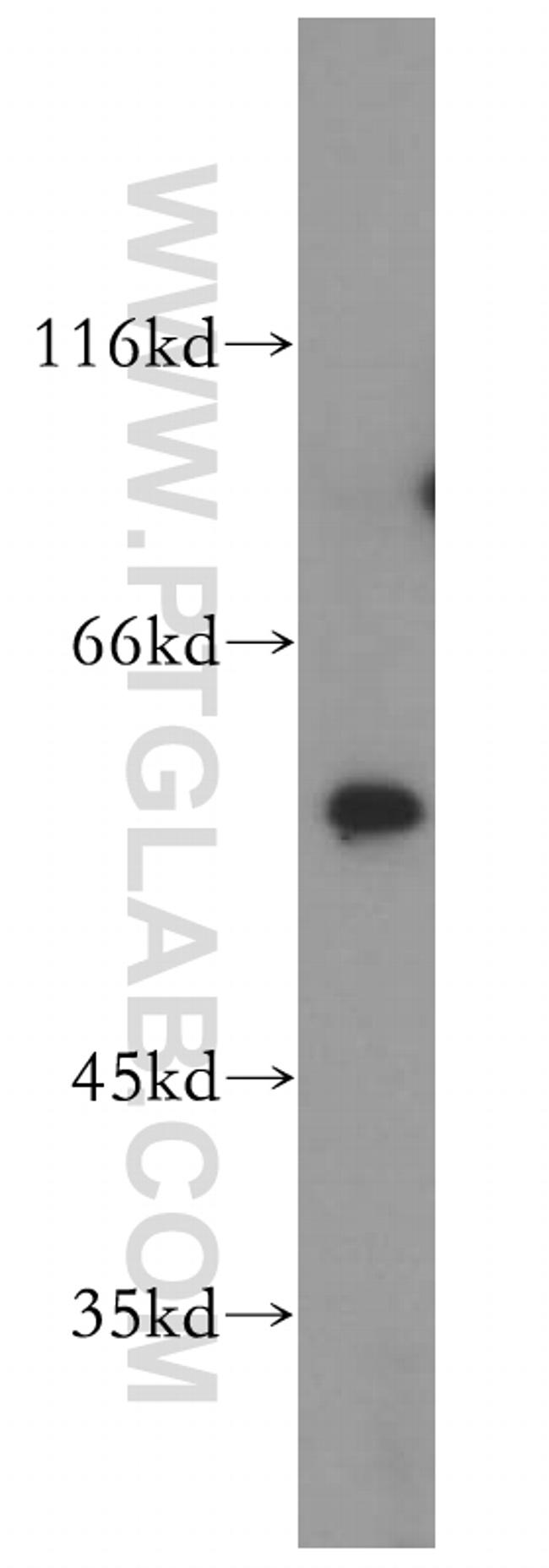 HMGCS1 Antibody in Western Blot (WB)