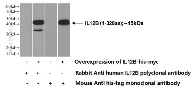 IL-12B Antibody in Western Blot (WB)