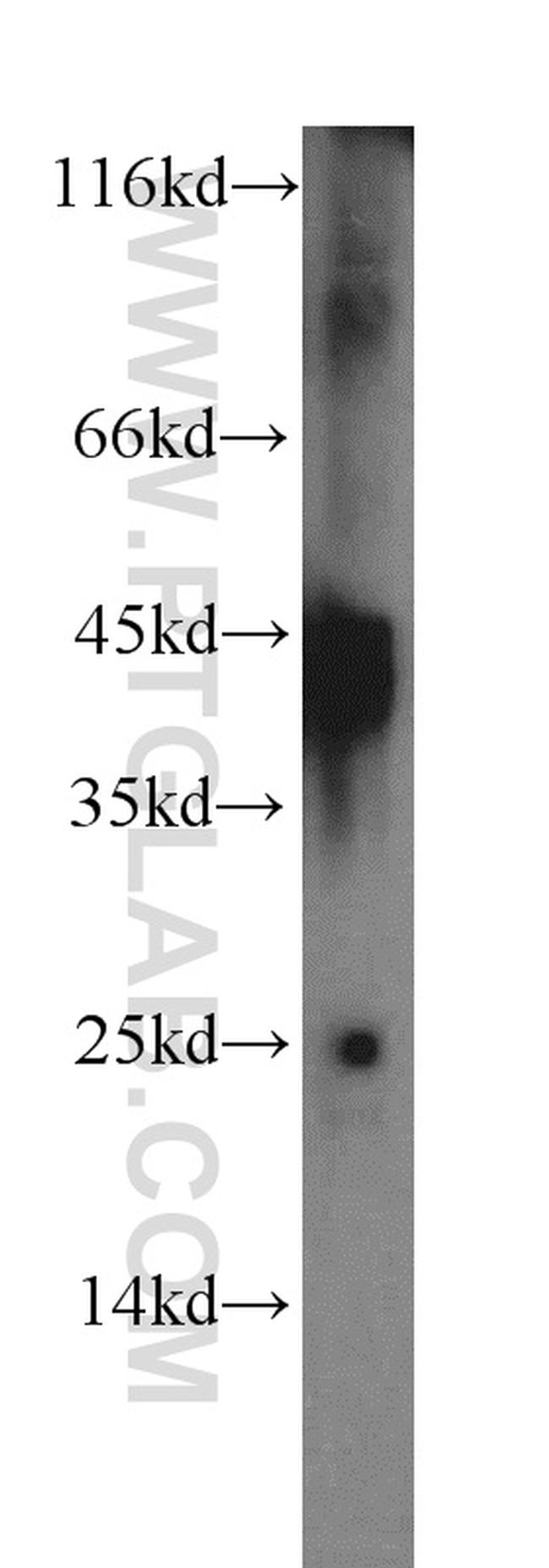 IL-12B Antibody in Western Blot (WB)