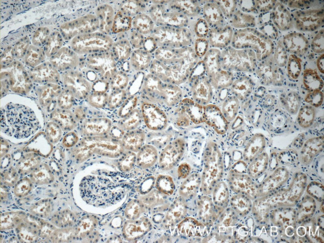 PAAF1 Antibody in Immunohistochemistry (Paraffin) (IHC (P))