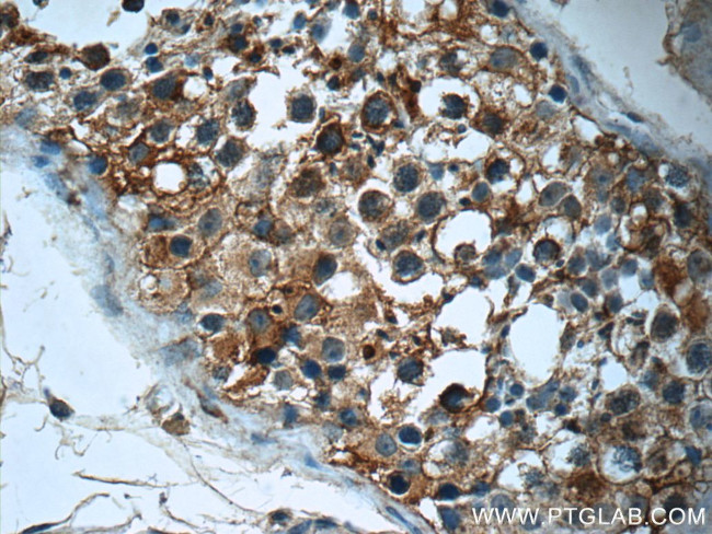 PAAF1 Antibody in Immunohistochemistry (Paraffin) (IHC (P))