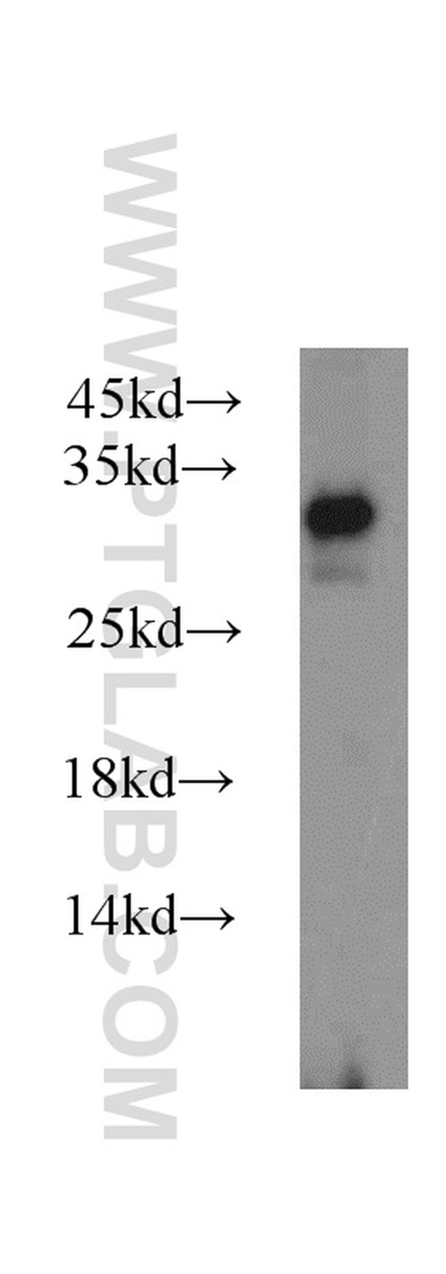 PAAF1 Antibody in Western Blot (WB)