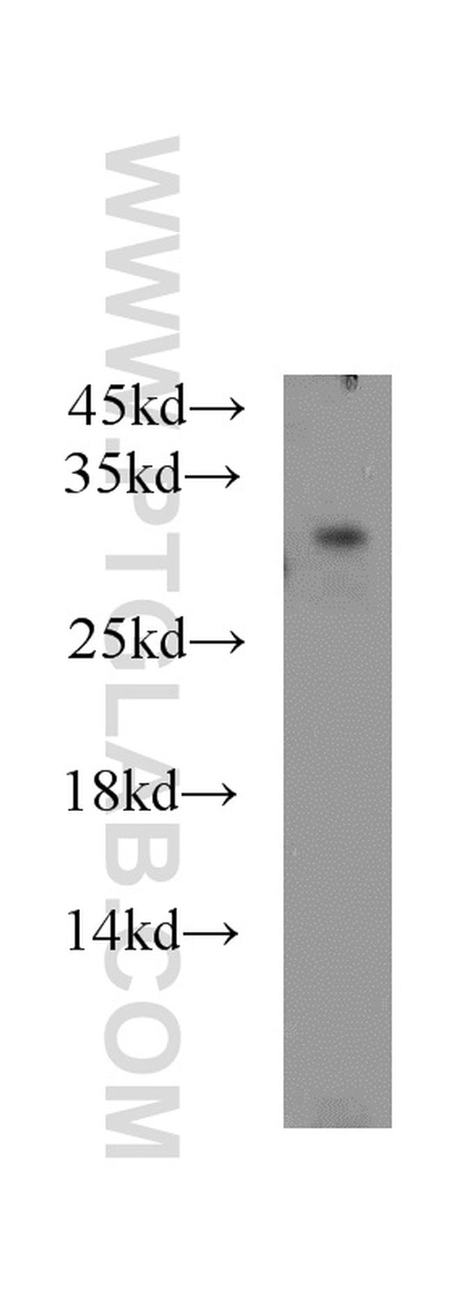 PAAF1 Antibody in Western Blot (WB)