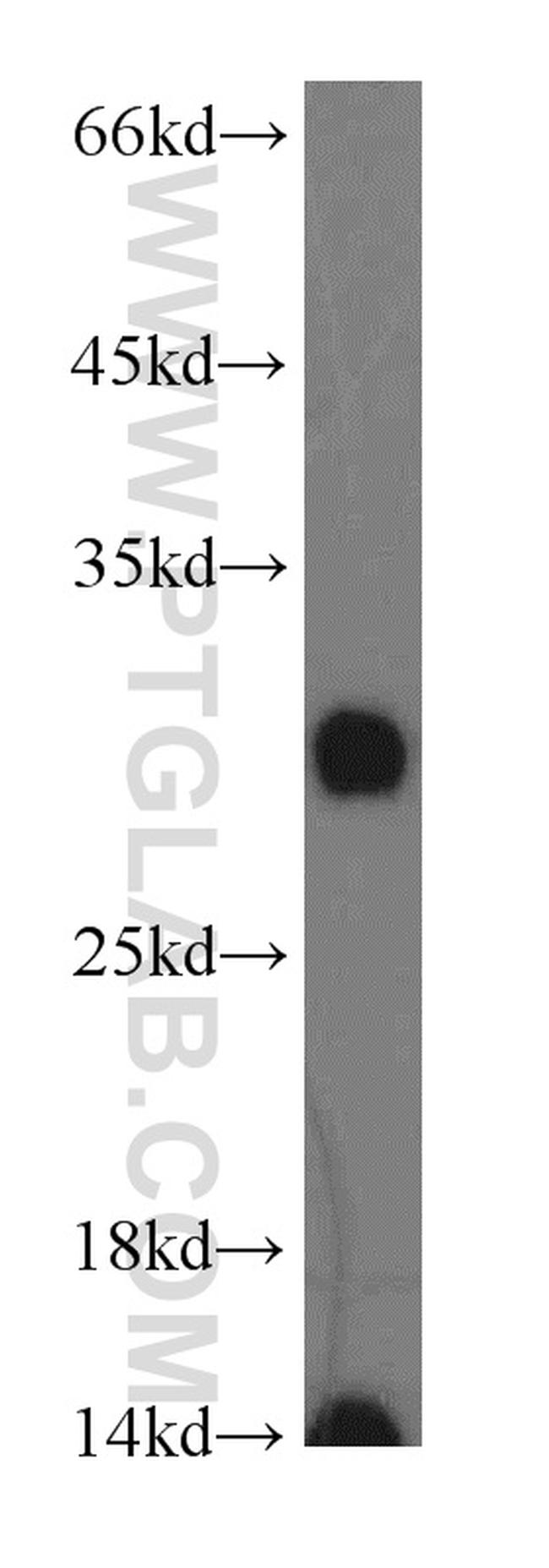 PAAF1 Antibody in Western Blot (WB)