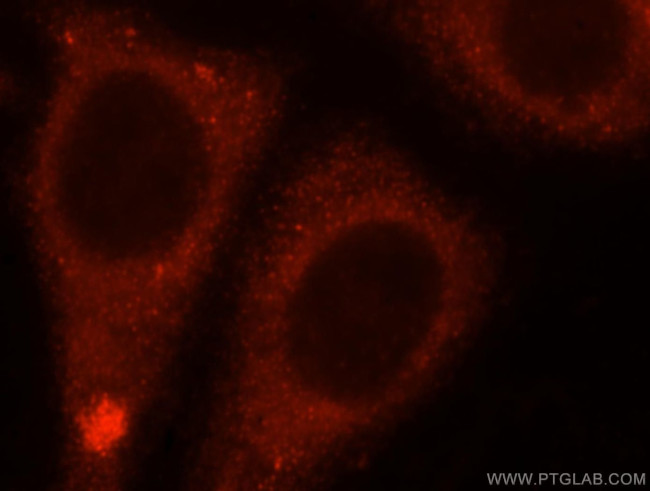 ENPEP Antibody in Immunocytochemistry (ICC/IF)