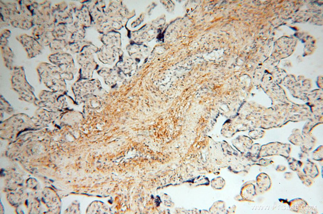 MFAP4 Antibody in Immunohistochemistry (Paraffin) (IHC (P))