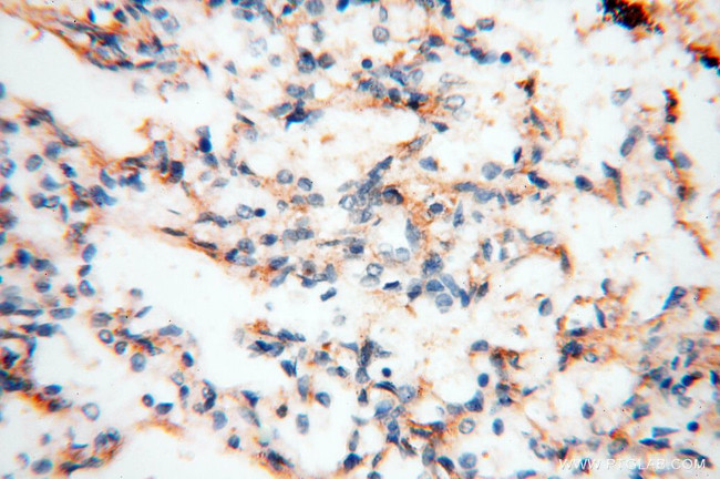 MFAP4 Antibody in Immunohistochemistry (Paraffin) (IHC (P))