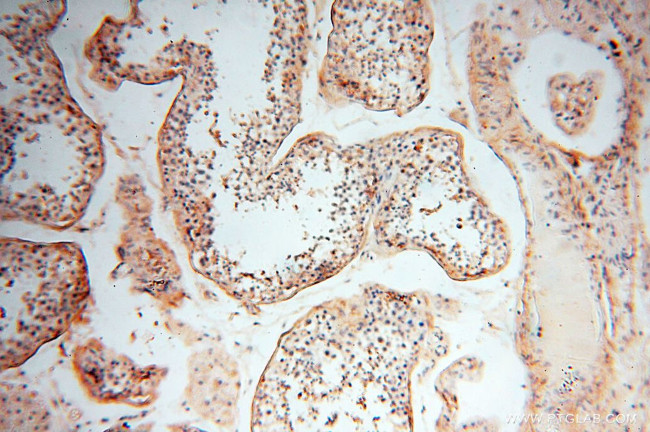 MFAP4 Antibody in Immunohistochemistry (Paraffin) (IHC (P))