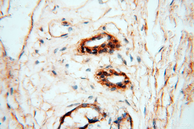 MFAP4 Antibody in Immunohistochemistry (Paraffin) (IHC (P))