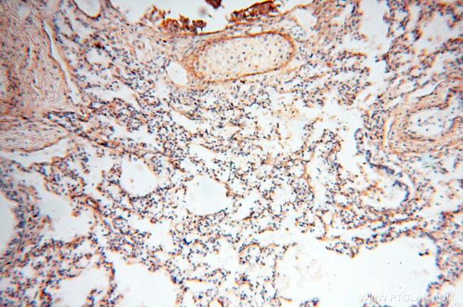 MFAP4 Antibody in Immunohistochemistry (Paraffin) (IHC (P))