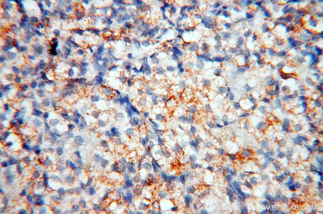 MFAP4 Antibody in Immunohistochemistry (Paraffin) (IHC (P))