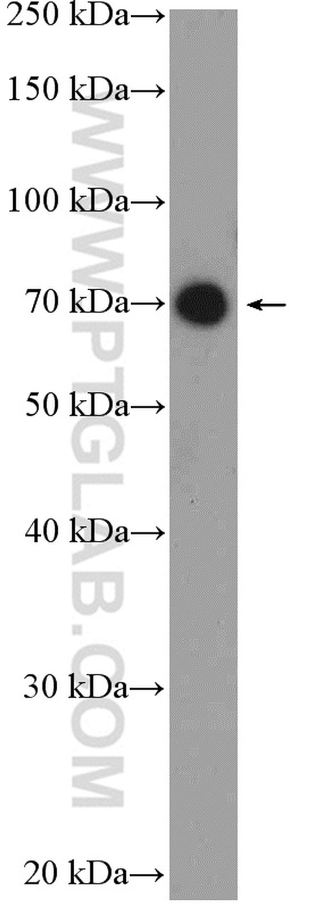 UTP6 Antibody in Western Blot (WB)