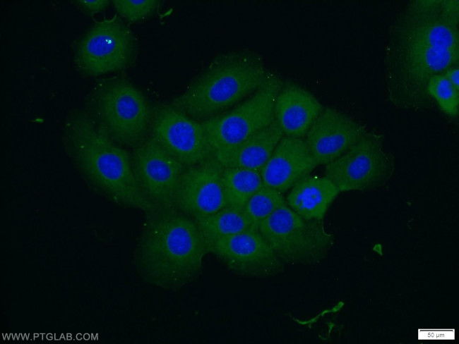 VPS4B Antibody in Immunocytochemistry (ICC/IF)