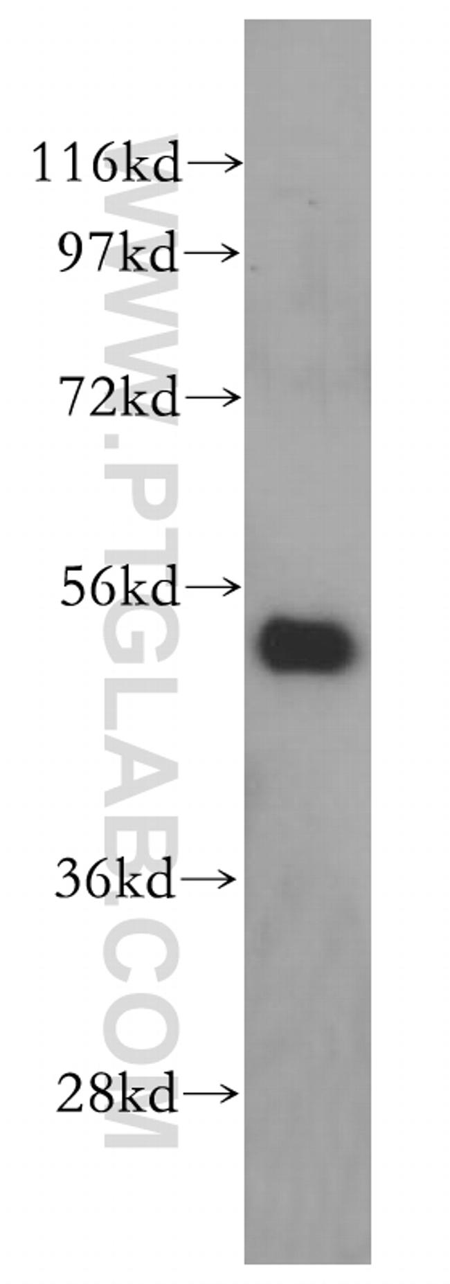 VPS4B Antibody in Western Blot (WB)