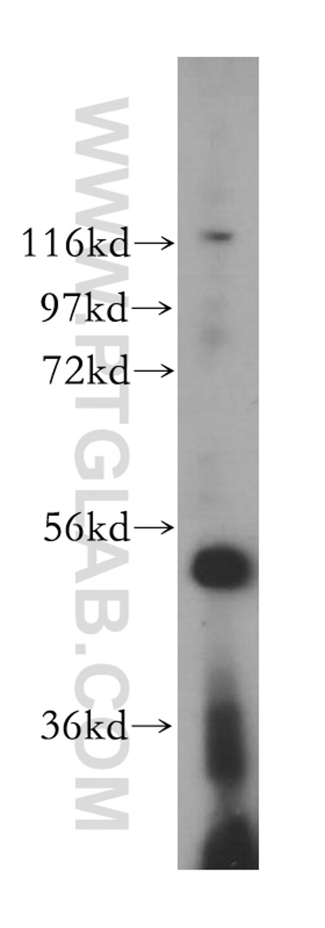 VPS4B Antibody in Western Blot (WB)