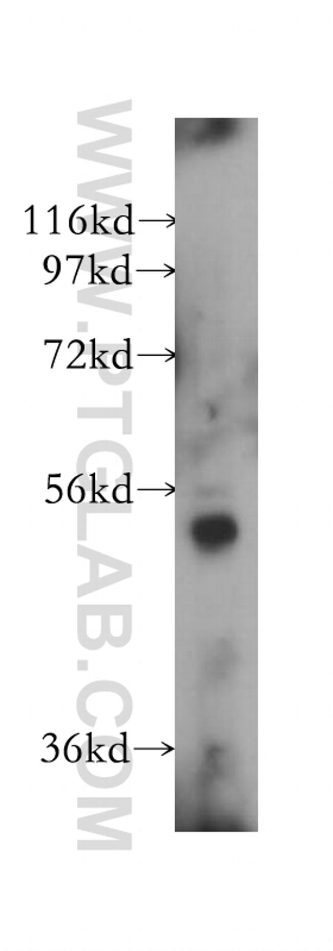 VPS4B Antibody in Western Blot (WB)