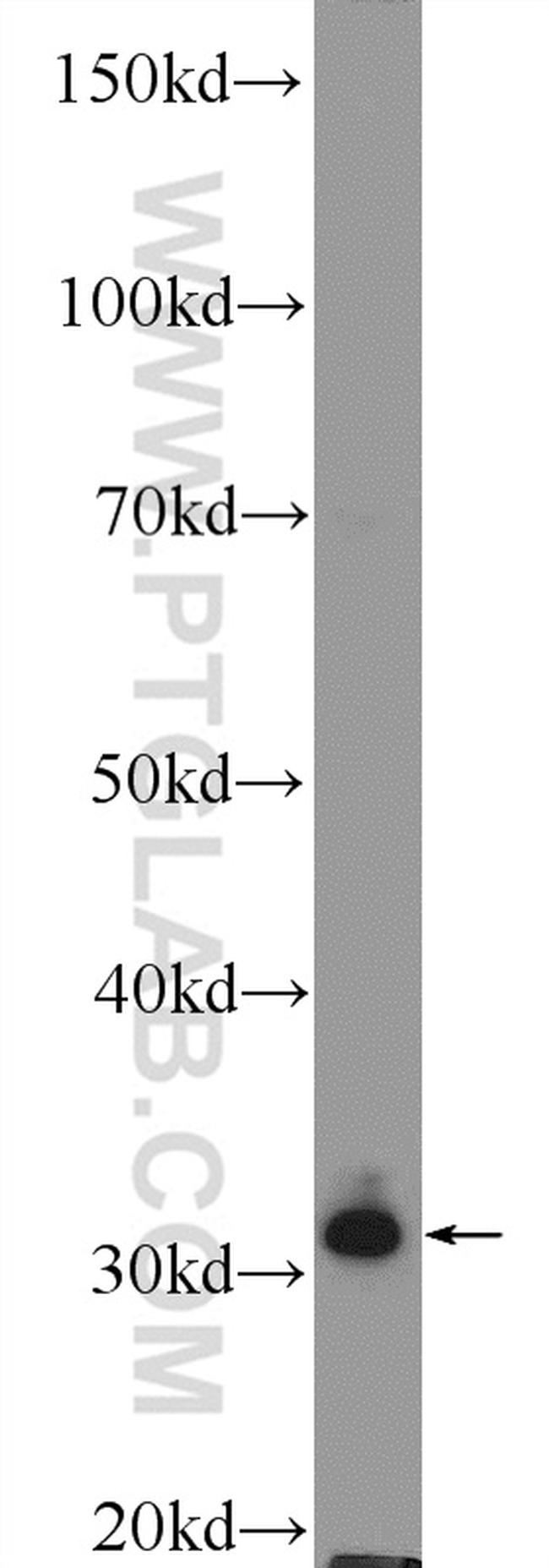 MSX1 Antibody in Western Blot (WB)