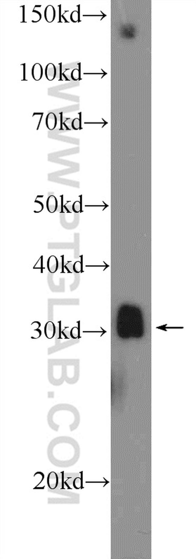 MSX1 Antibody in Western Blot (WB)