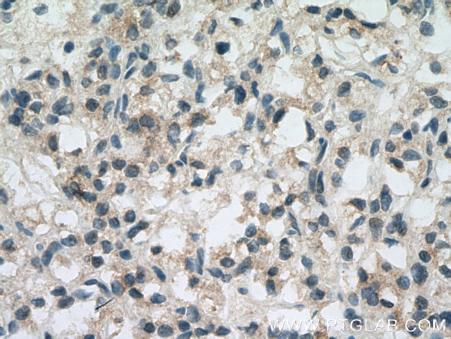 AHNAK2 Antibody in Immunohistochemistry (Paraffin) (IHC (P))