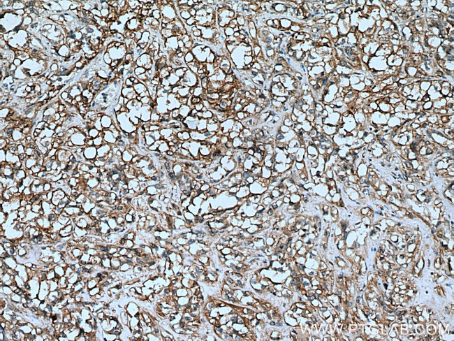 AHNAK2 Antibody in Immunohistochemistry (Paraffin) (IHC (P))