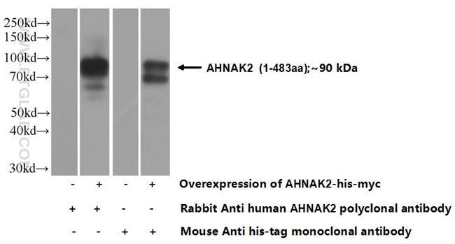 AHNAK2 Antibody in Western Blot (WB)