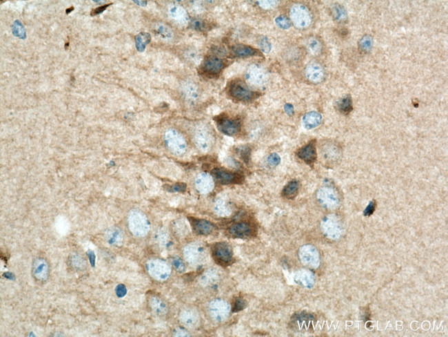 VEZT Antibody in Immunohistochemistry (Paraffin) (IHC (P))