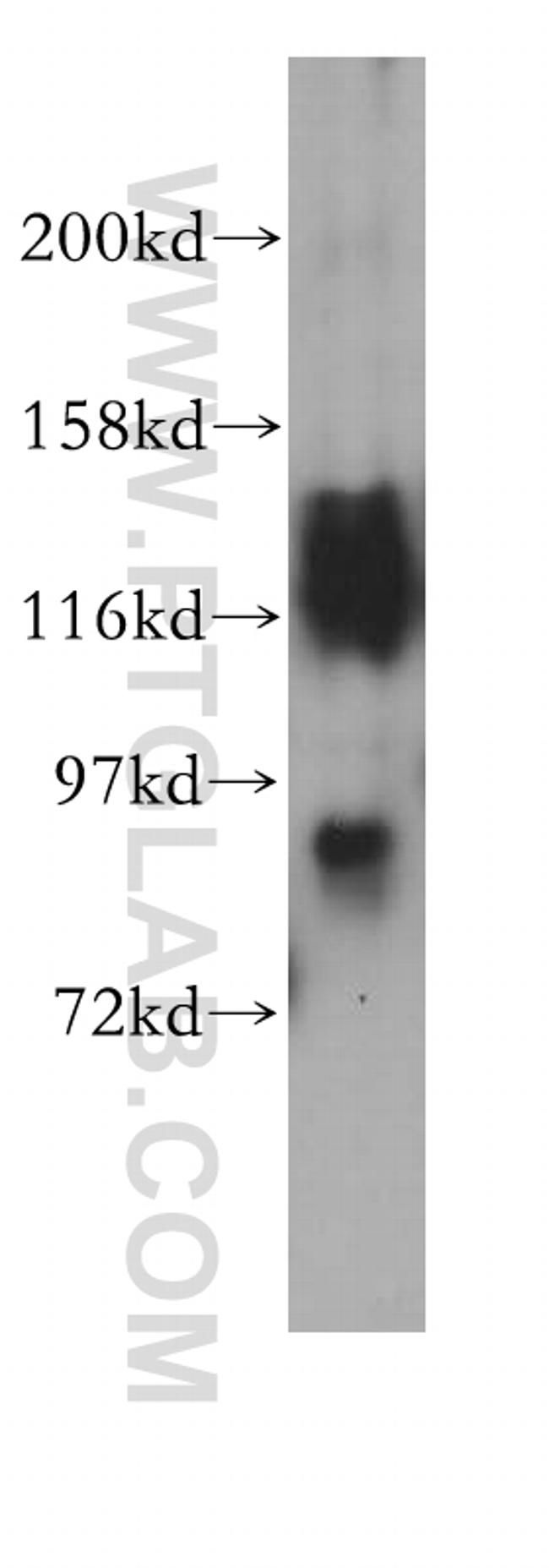 VEZT Antibody in Western Blot (WB)