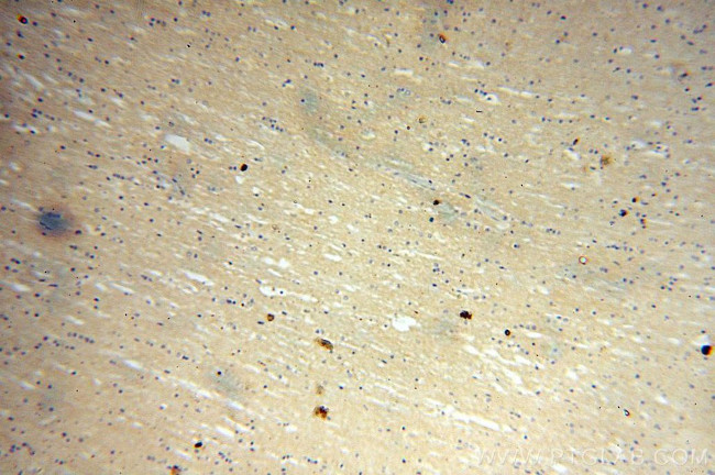 VEZT Antibody in Immunohistochemistry (Paraffin) (IHC (P))