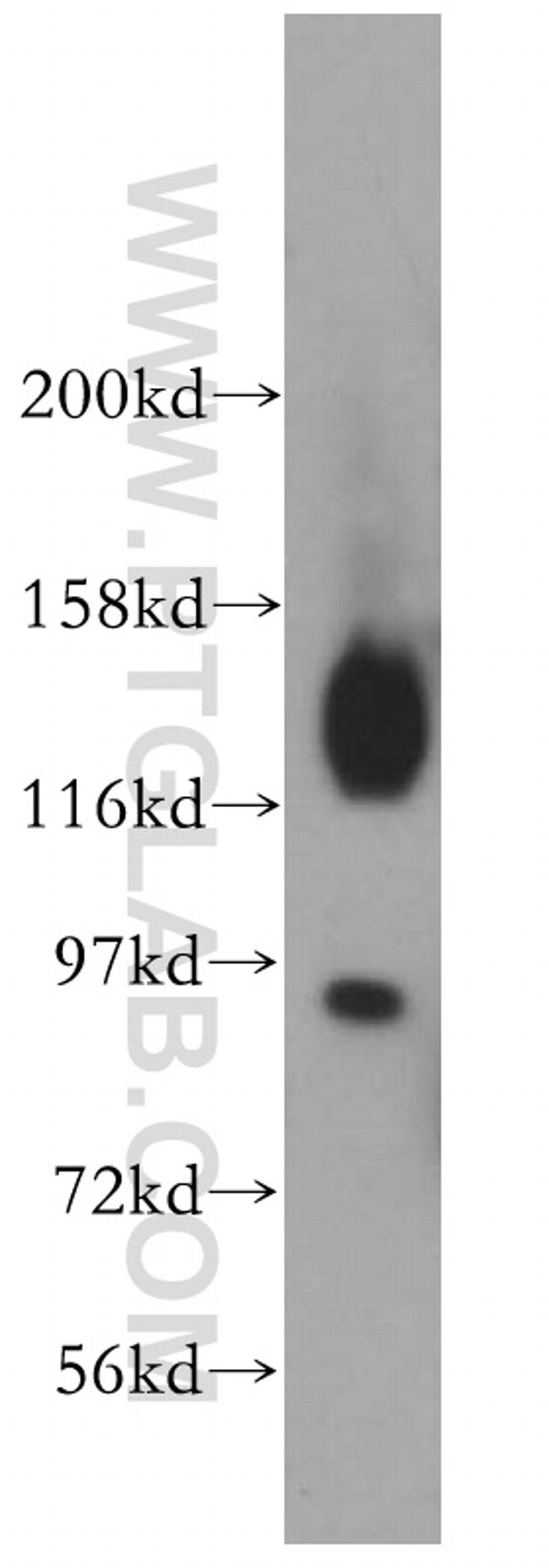 VEZT Antibody in Western Blot (WB)