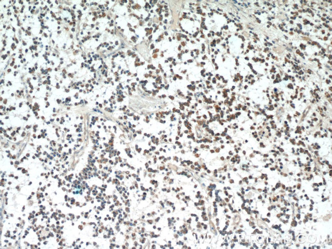 ABL2 Antibody in Immunohistochemistry (Paraffin) (IHC (P))