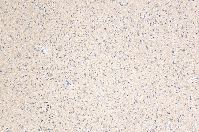 ABL2 Antibody in Immunohistochemistry (Paraffin) (IHC (P))