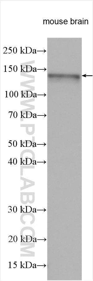 ABL2 Antibody in Western Blot (WB)