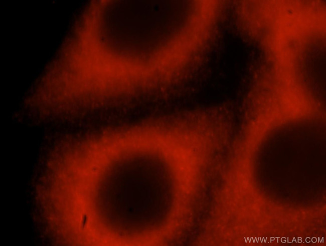 ABL2 Antibody in Immunocytochemistry (ICC/IF)