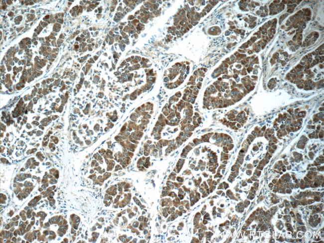 ABL2 Antibody in Immunohistochemistry (Paraffin) (IHC (P))