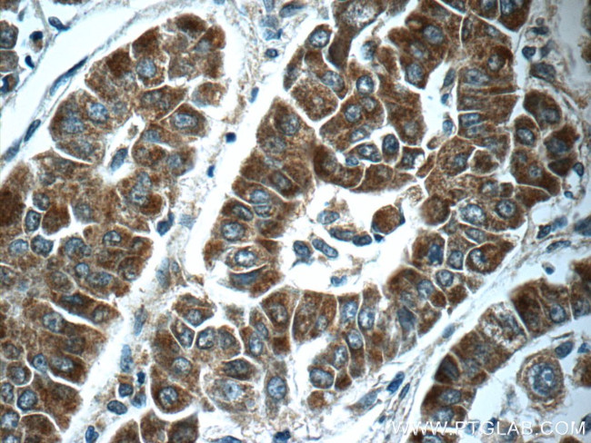 ABL2 Antibody in Immunohistochemistry (Paraffin) (IHC (P))