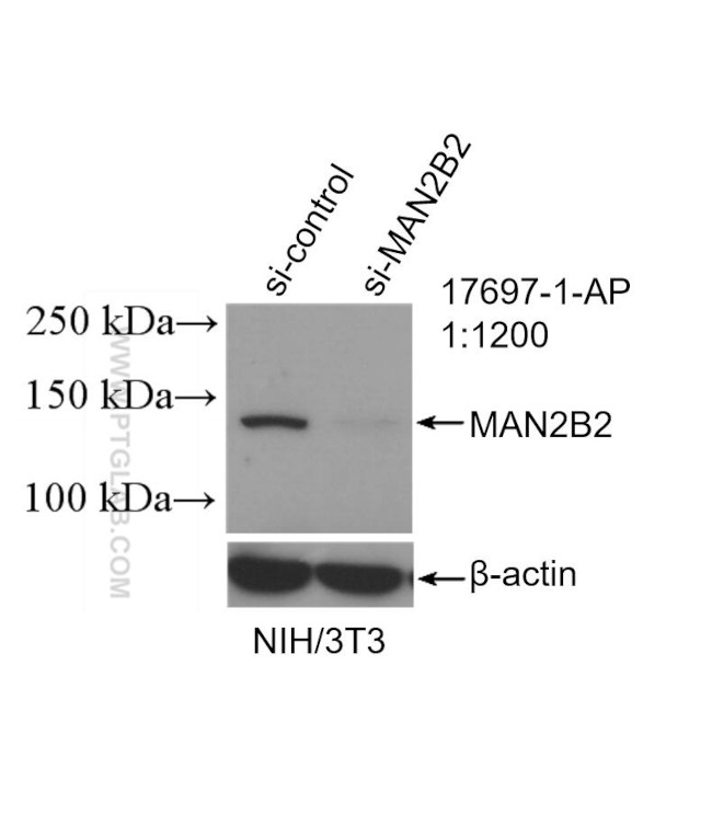 MAN2B2 Antibody in Western Blot (WB)