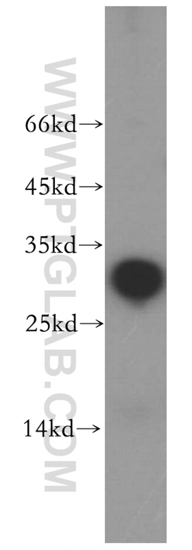 NRIP2 Antibody in Western Blot (WB)