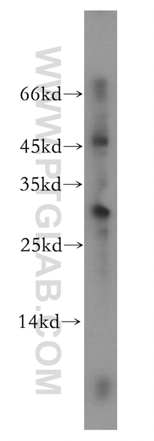 NRIP2 Antibody in Western Blot (WB)