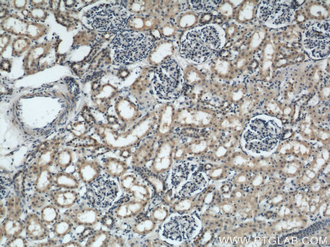 ARL13B Antibody in Immunohistochemistry (Paraffin) (IHC (P))